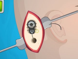 Operate Now: Ear Surgery - 4 